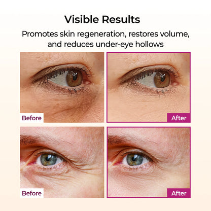 🔥2026 Hot Sale ✨Cemenrete Calcium Multi Balm,Cosmetics with Collagen Extract Elasticity Eye Shiel dSkin Repair
