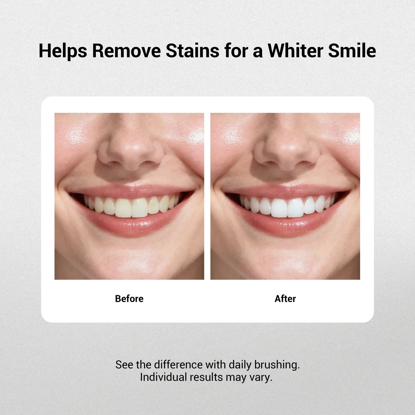 🏆Flash Sale⚡ 50K+ SOLD! Almost Gone-💥🔥New 7-Pro Intensive Toothpaste -🦷Deep Enamel Repair & Long-Lasting Freshness