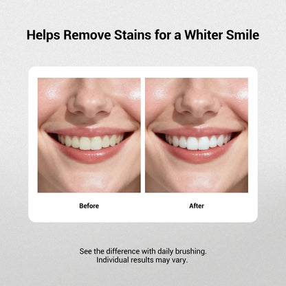 🏆Flash Sale⚡ 50K+ SOLD! Almost Gone-💥🔥New 7-Pro Intensive Toothpaste -🦷Deep Enamel Repair & Long-Lasting Freshness