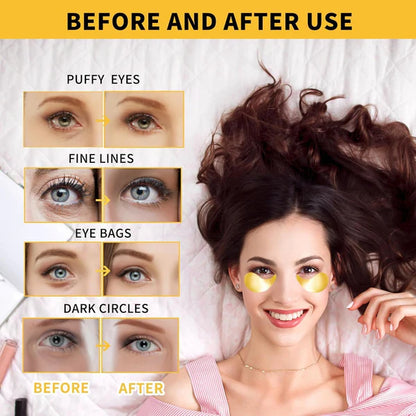 【💥New product】Collagen & Retinol 24K Gold Under Eye Patches with  – For Dark Circles, Puffiness & Wrinkles