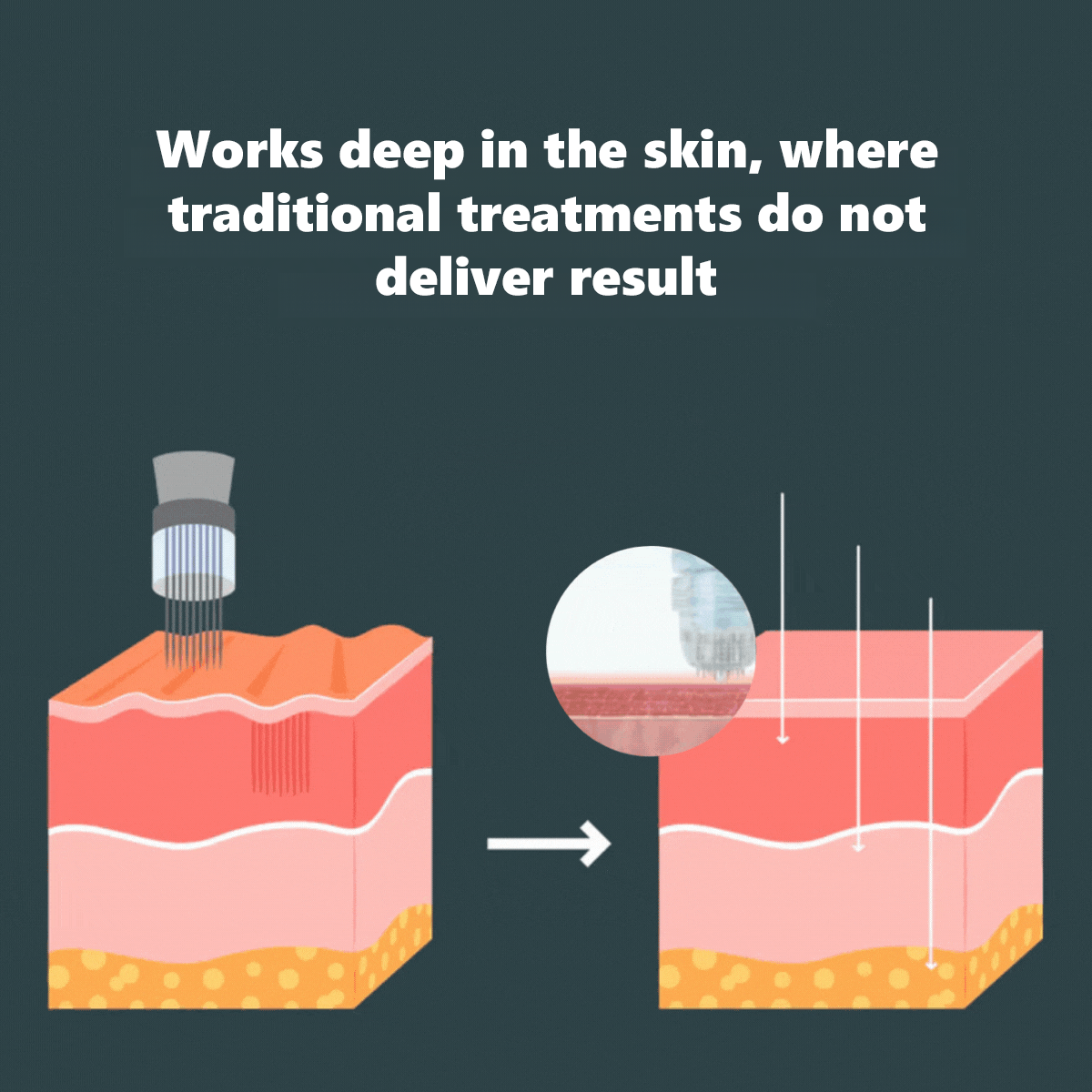💖Limited-time offer💖Salmon DNA Microneedle Hydrating Essence🧬