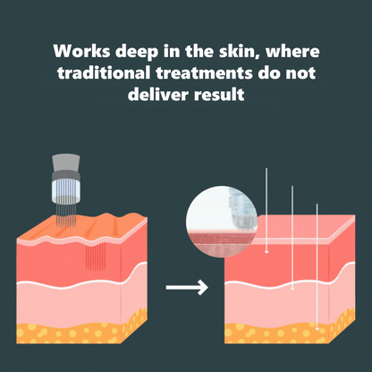 💖Limited-time offer💖Salmon DNA Microneedle Hydrating Essence🧬